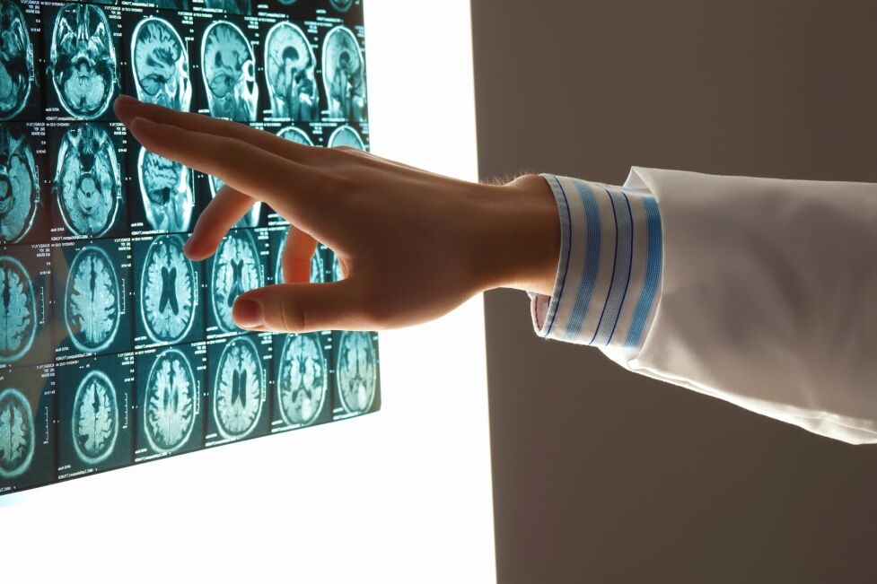 TBI lawyer West Valley City, UT